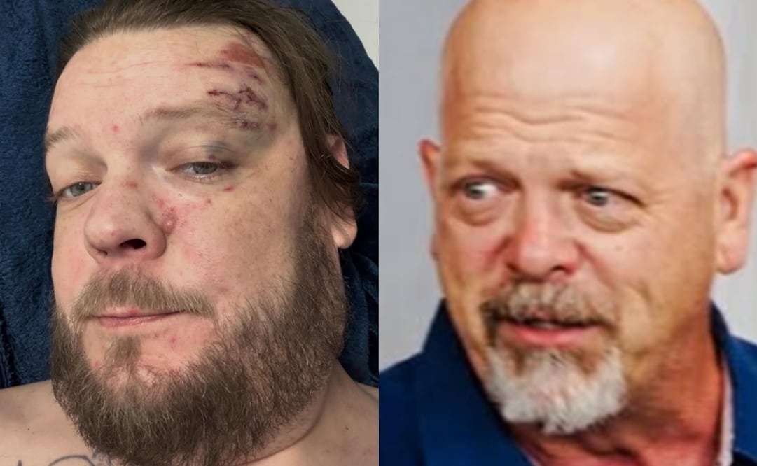 Corey Harrison sufrió un accidente en moto en Tulum, Quintana Roo en enero. Foto: Instagram oficial.