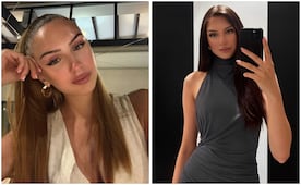 ¿Quién era Lucia Sisic? Miss Universo de Austria 2024 muere a los 22 años; se sometió a 7 cirugías de corazón