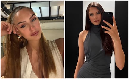 ¿Quién era Lucia Sisic? Miss Universo de Austria 2024 muere a los 22 años; se sometió a 7 cirugías de corazón