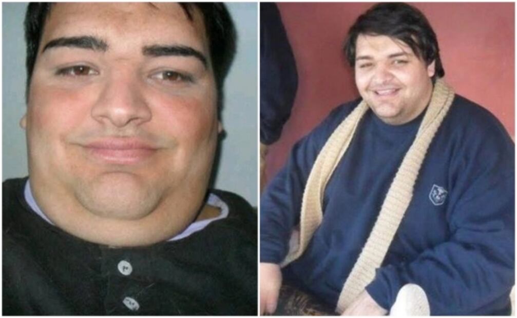 El hombre que se operó más de 20 veces para parecerse a Ricky Martin