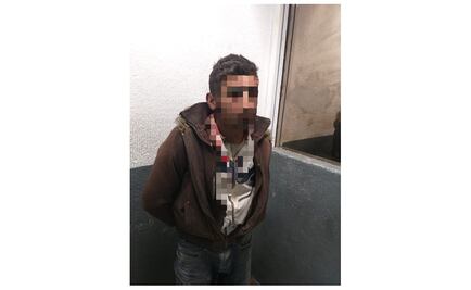 Sujeto ataca con machete a hombre que caminaba por calles de Xochimilco 