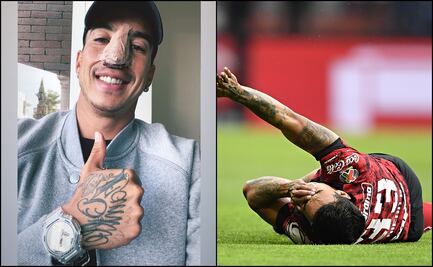 El Toluca perderá a Diego Rigonato para la vuelta ante el Cruz Azul 