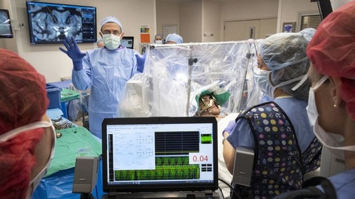 El doctor Ali Rezai y su equipo llevaron a cabo el procedimiento a principios de este mes. Foto: Hospital de la Universidad de Virginia Occidental / BBC