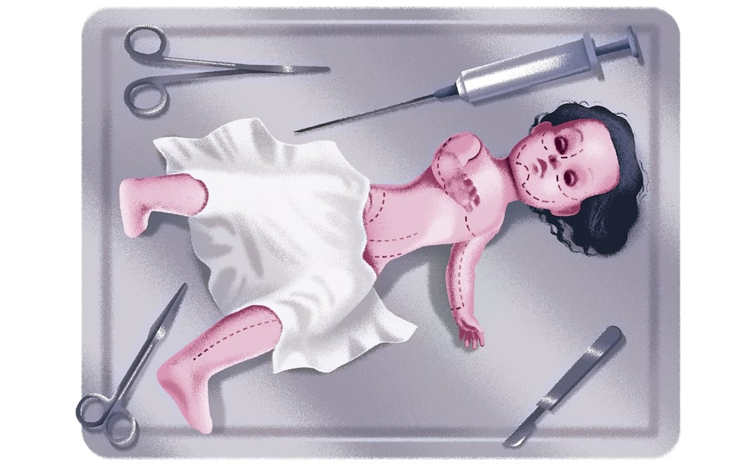 Especialistas advierten que las cirugías estéticas en adolescentes conllevan riesgos considerables. Ilustración: Iván Vargas