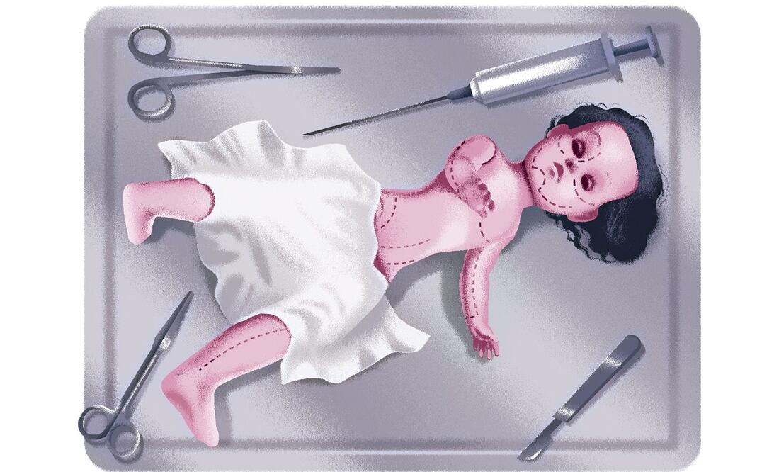 Especialistas advierten que las cirugías estéticas en adolescentes conllevan riesgos considerables. Ilustración: Iván Vargas