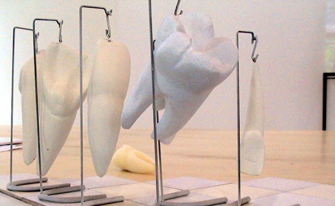 Obra sin título de Tunga, que presenta un impresionante ajedrez en el que las piezas son dientes de plástico, casi de la talla de una persona. FOTO: Archivo.