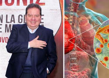 ¿Cuáles son los síntomas de la bronconeumonía, enfermedad que hospitalizó a Coque Muñiz?