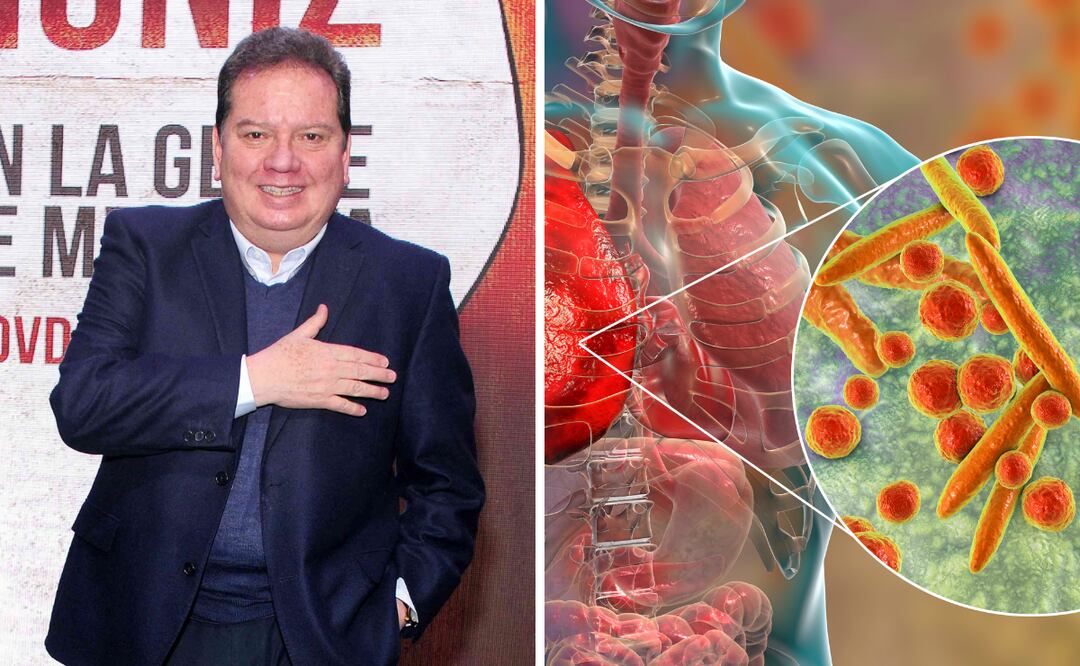 ¿Cuáles son los síntomas de la bronconeumonía, enfermedad que hospitalizó a Coque Muñiz?
Foto: El Universal