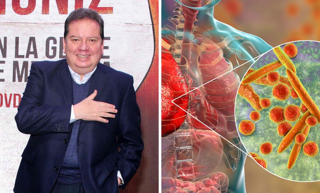 ¿Cuáles son los síntomas de la bronconeumonía, enfermedad que hospitalizó a Coque Muñiz?
Foto: El Universal