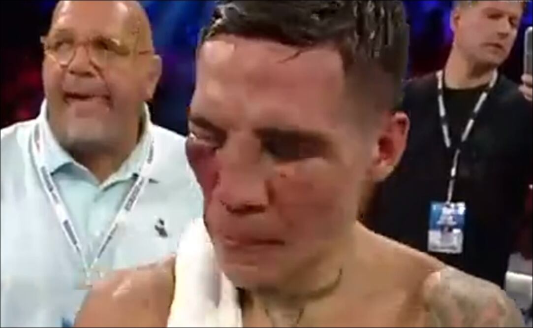 El rostro de Oscar Valdez sufrió una serie de lesiones  - Foto: Especial