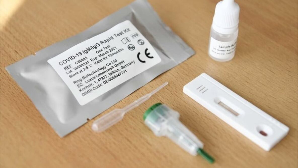 Países de Europa han reportado problemas con los kit de pruebas rápidas de covid-19 elaborados en China. Foto: EPA