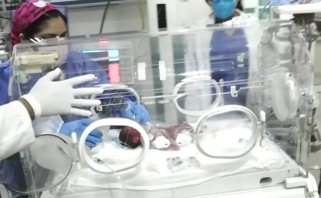 Foto: Especiales/ El bebé fue trasladado al hospital Las Américas 