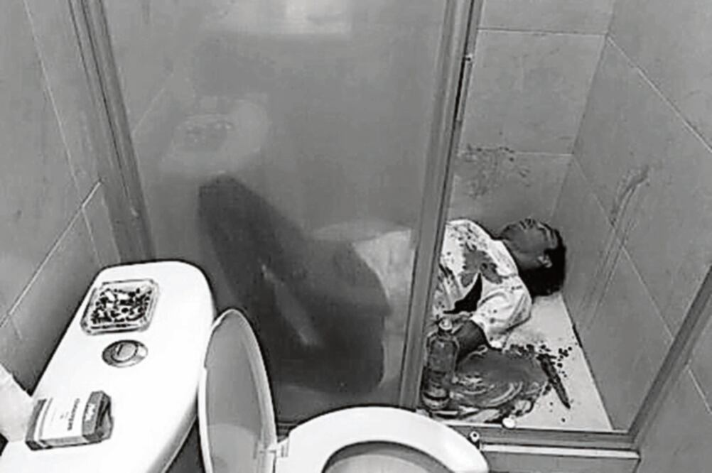 El músico se hizo varios cortes con una navaja el miércoles (CORTESÍA)