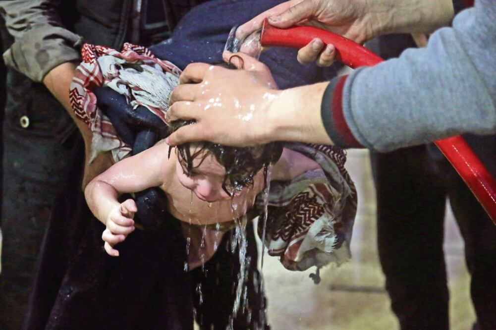 Un niño es tratado en un hospital de Duma, tras el presunto ataque químico que se registró en esa ciudad de Siria (REUTERS)