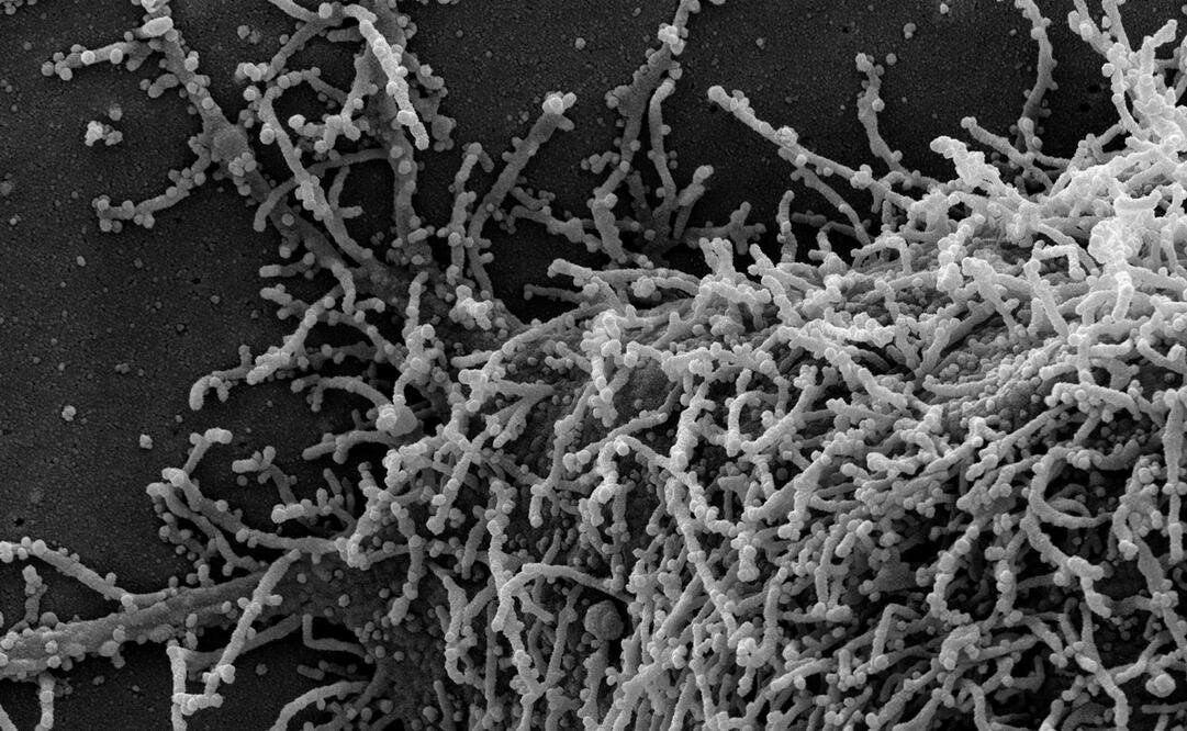 Foto: EFE/EPA/NIAID/NATIONAL INSTITUTES OF HEALTH 