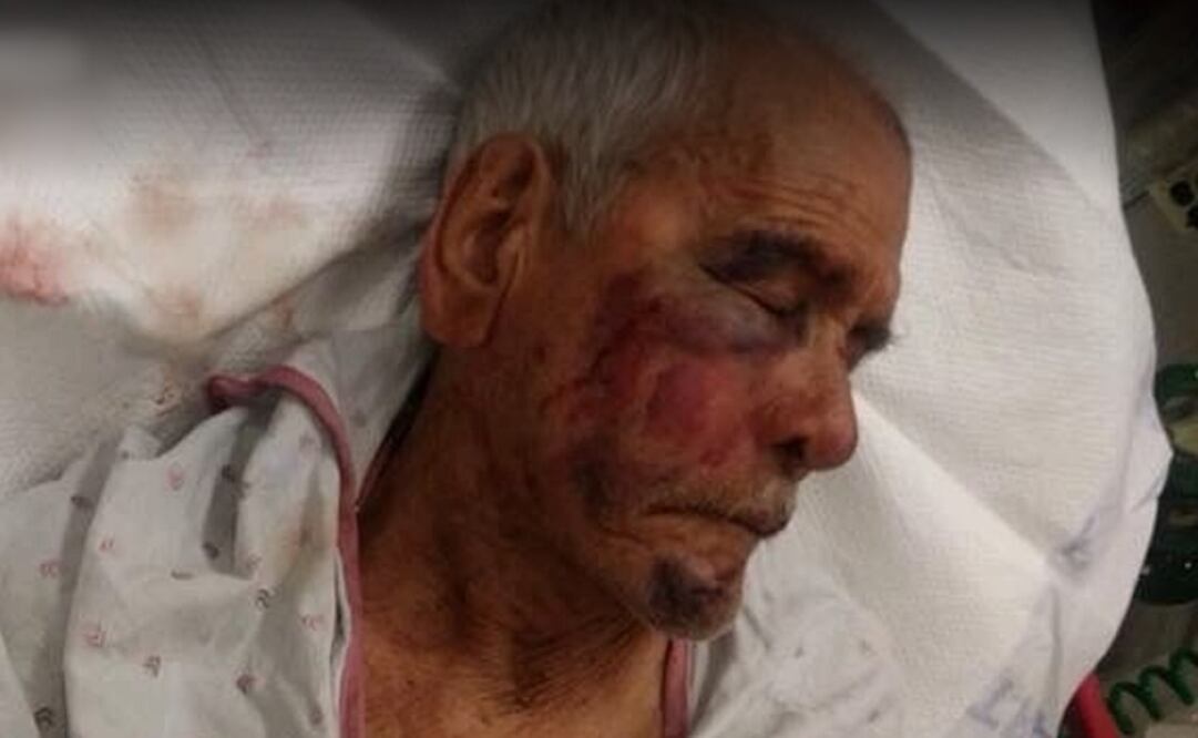 Rodolfo Rodríguez, un mexicano de 91 años, en recuperación tras la agresión (Foto: Captura de la plataforma GoFundMe)