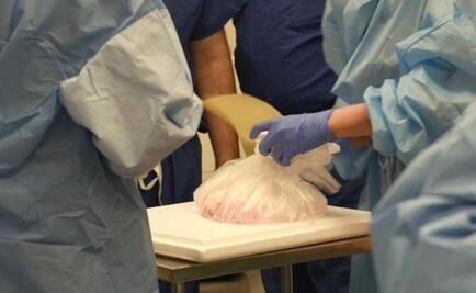 Realizan el primer trasplante completo de pene y escroto en el mundo