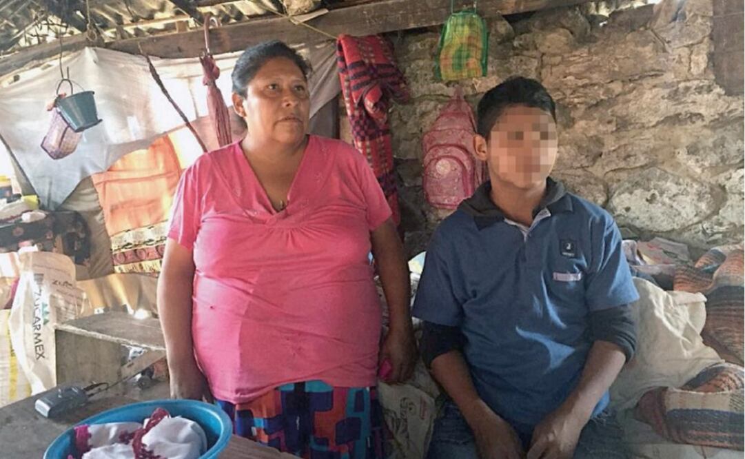 Javier Chino Nieves, 15, hasn't attended school since last Thursday because he was beaten by federal police for participating in a protest. (Photo: Vania Pigeonutt / EL UNIVERSAL) 