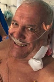 Así luce dueño de safari, tras ataque de león 