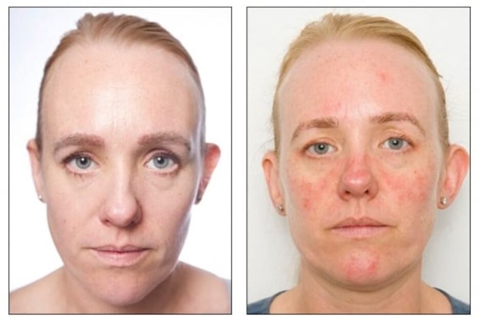 Conoce la importancia de lavarse la cara antes de dormir