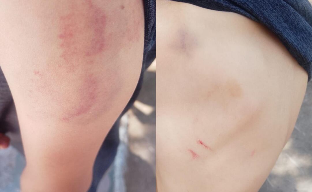 Menor bajo resguardo de la casa del niño DIF en Pachuca es agredido físicamente (19/05/2025). Foto: Especial