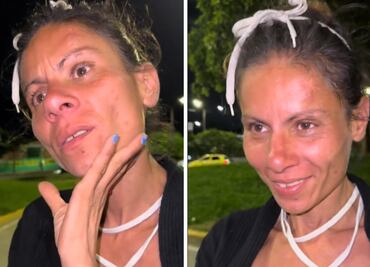 De pasarelas a vivir en la calle; la historia de Karina, exmodelo de Stock Models