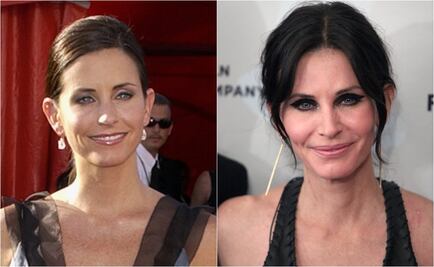 Actriz de "Friends" lamenta intervenciones estéticas