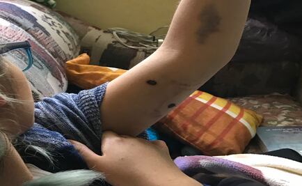 Estudiante de CCH recibe tres impactos de bala en asalto