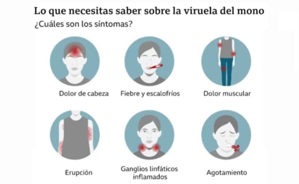 OMS declara brote de viruela del mono como emergencia internacional