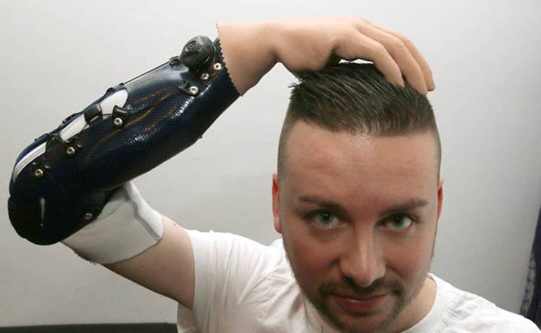 Se le pidió que identificara qué dedo de su mano estaba siendo tocado. Foto: Archivo