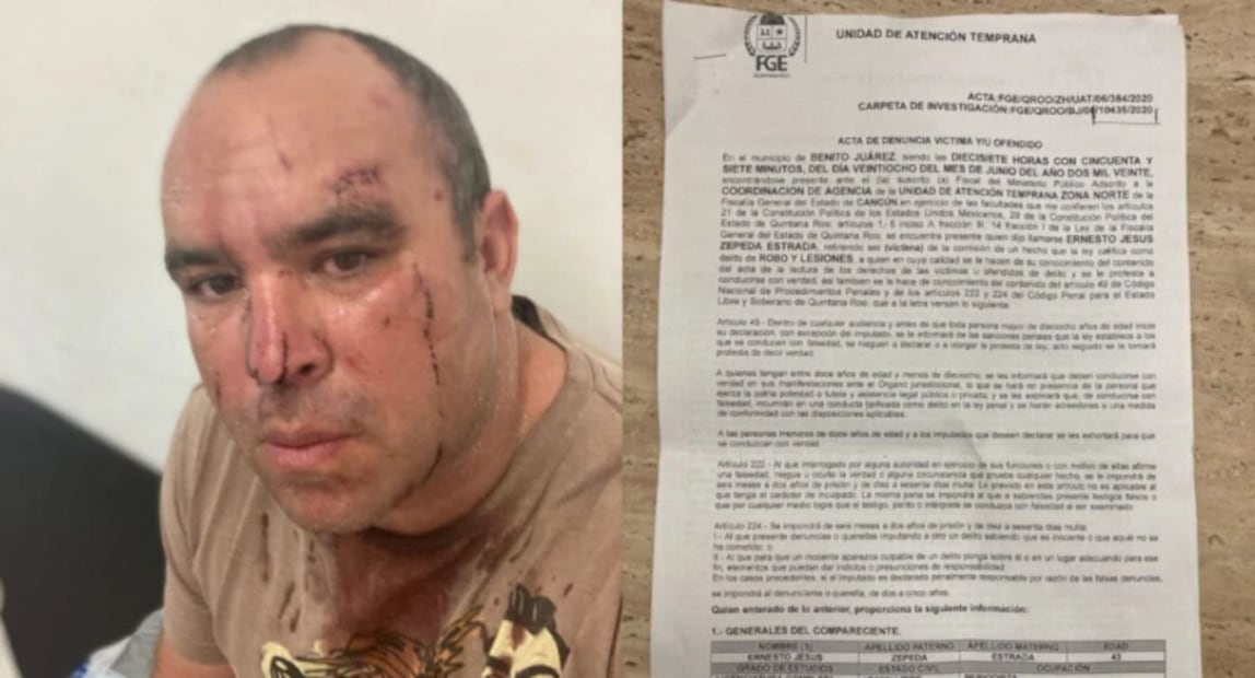 En 2020 el fotógrafo acusó a Brito y su pareja del momento, de haberlo agredido físicamente y dañado su equipo de trabajo. Foto: Redes sociales