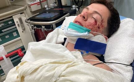 Guaynaa sufre fuerte accidente automovilístico en Los Ángeles