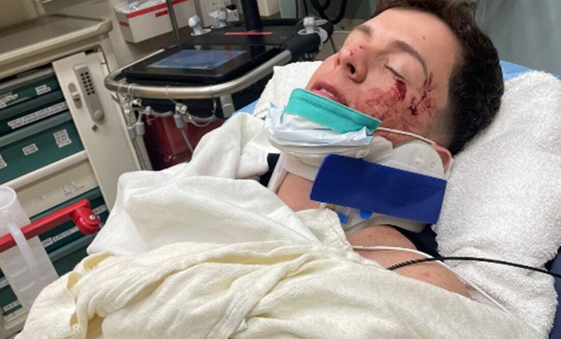 El artista puertorriqueño sufrió duros golpes y traumas. Foto: EFE