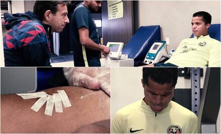 América lanza mini documental de la terrible lesión de Giovani