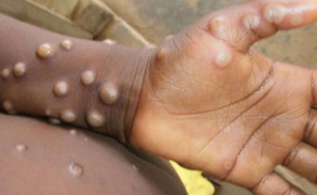 Foto: Archivo EL UNIVERSAL 