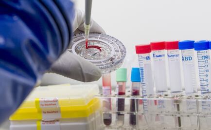 UAM scientists create optical tweezers to capture red blood cells