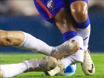 Hobbit Bermúdez sufrió una brutal agresión y fue enviado al hospital