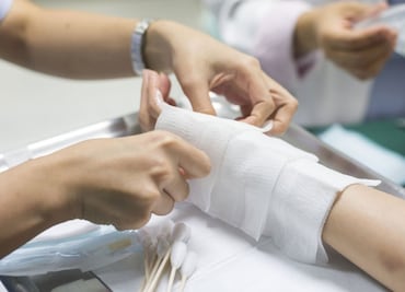 Desarrollan nuevos materiales para cicatrización de heridas por quemaduras