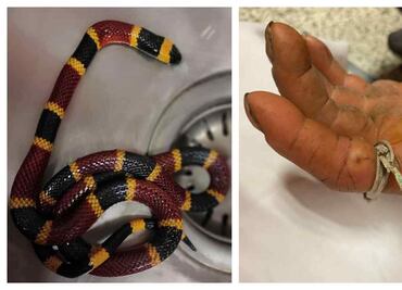 Atienden en Hospital General de Pachuca a un hombre por picadura de víbora coralillo