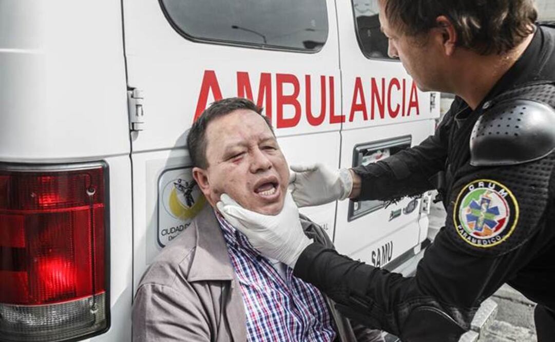  INBA workers stimate that between six and seven colleagues were wounded, and four more were arrested. (Photo: Yadín Xolalpa / EL UNIVERSAL) 