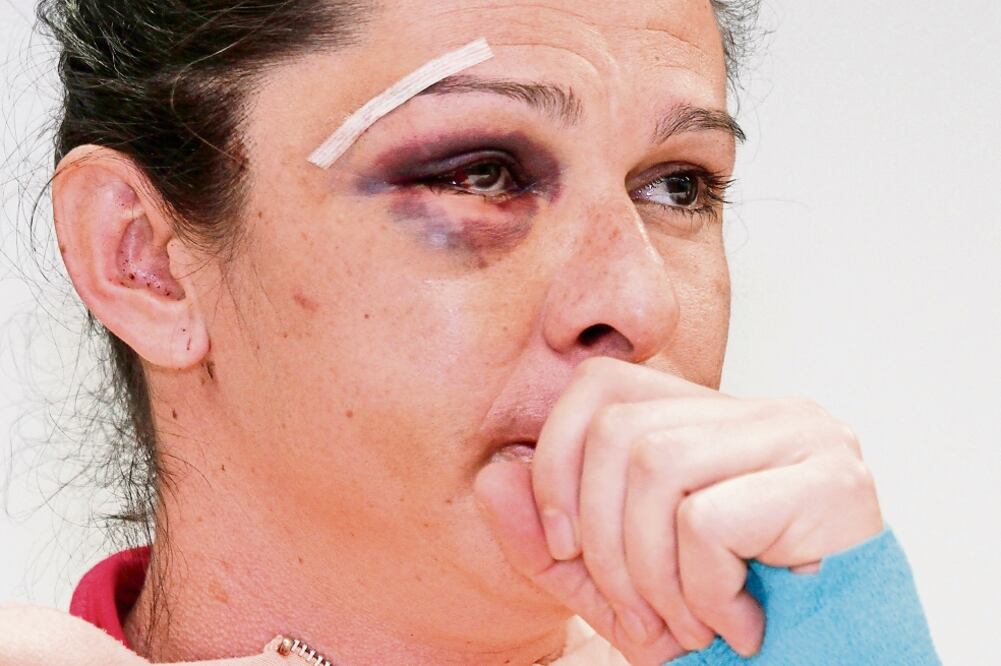 Ana Gabriela calificó como “cobarde” el ataque que vivió el domingo (IRVIN OLIVARES. EL UNIVERSAL)