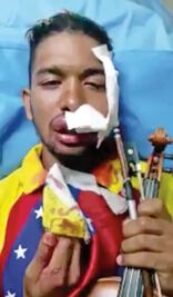 “La violencia promovida por el régimen, lo más grave”