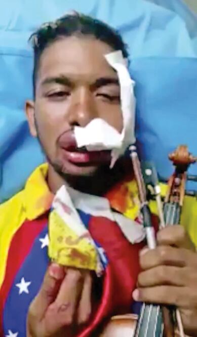 Wuilly Arteaga Violinista y opositor venezolano (ROBERT CARMONA-BORJAS. AFP)