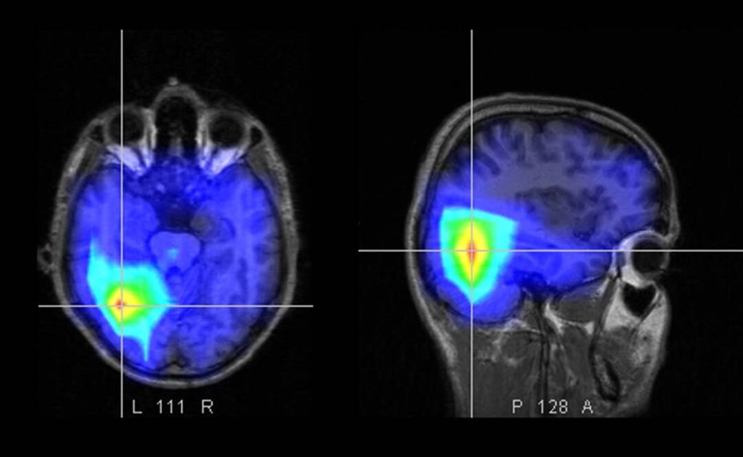 Se conoce como optogenética al desarrollo y combinación de métodos genéticos y ópticos para controlar reacciones específicas en ciertas células de tejidos vivos. Foto: Archivo