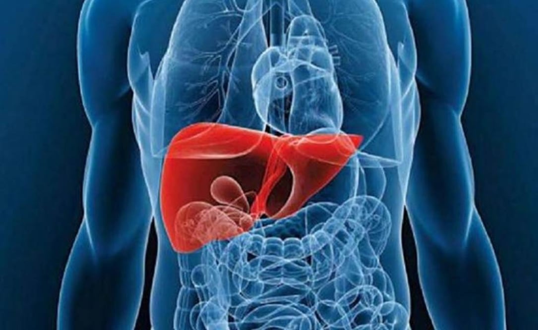 Detectada en su etapa tardía de cirrosis, la fibrosis hepática es irreversible y mortal (ESPECIAL)