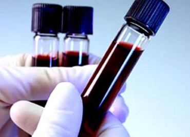 Gobierno británico comenzará a indemnizar este año a víctimas del escándalo de sangre contaminada