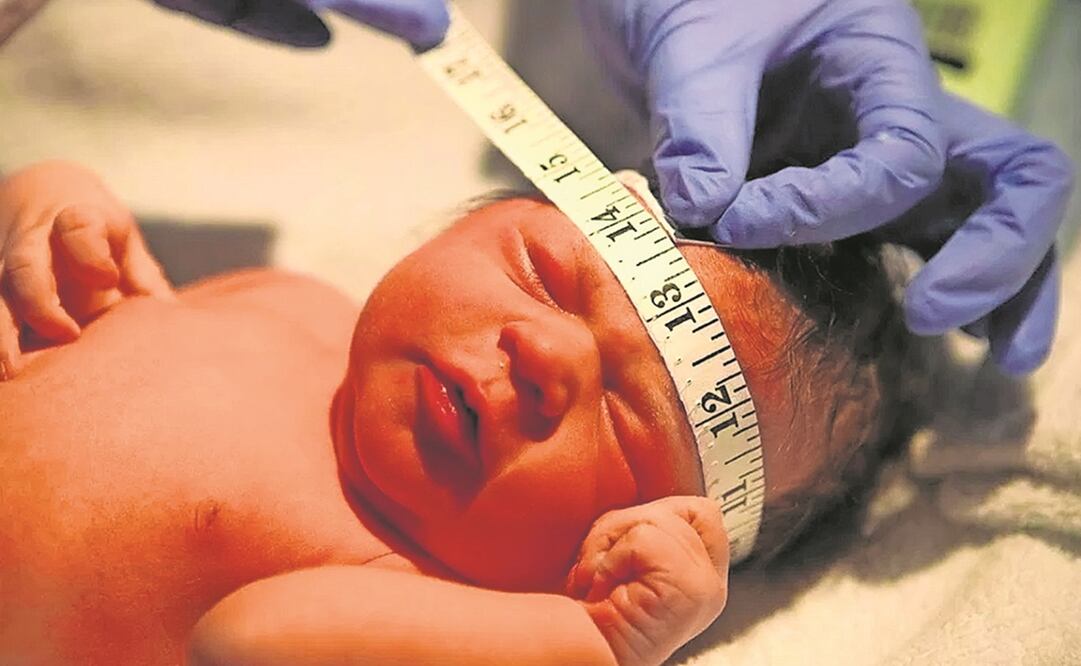 Conforme el cerebro crece, el cráneo puede deformarse cada vez más. Foto: ESPECIAL