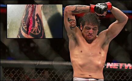 La espeluznante herida que sufrió un peleador mexicano en UFC 