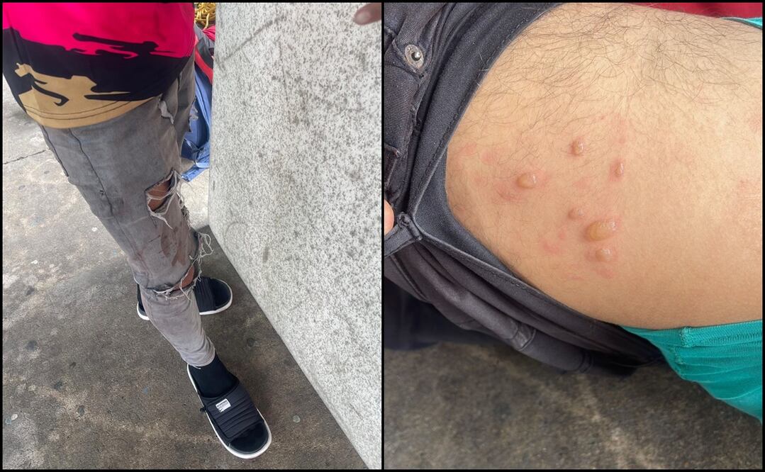 Algunos adultos y menores de edad tienen lesiones por los golpes, además aseguran que les quitaron su dinero, celulares, documentos y otras pertenencias. Foto: Especial