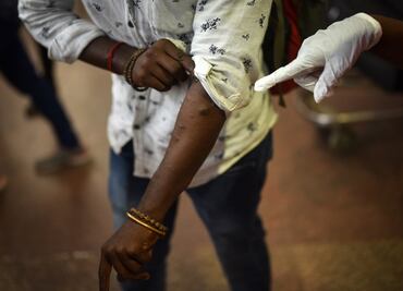 Irán detecta primer caso de viruela del mono